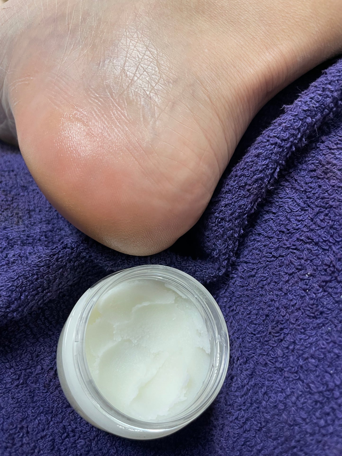 Foot Balm