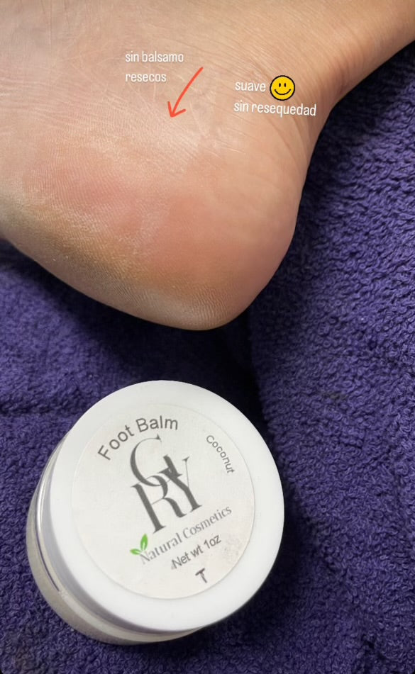 Foot Balm